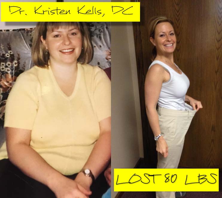 Dr Kristen Kells Before and After Dr Kristen Kells Before and After