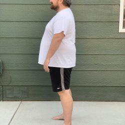 Matt White Before Dr. Kells' Weight Loss