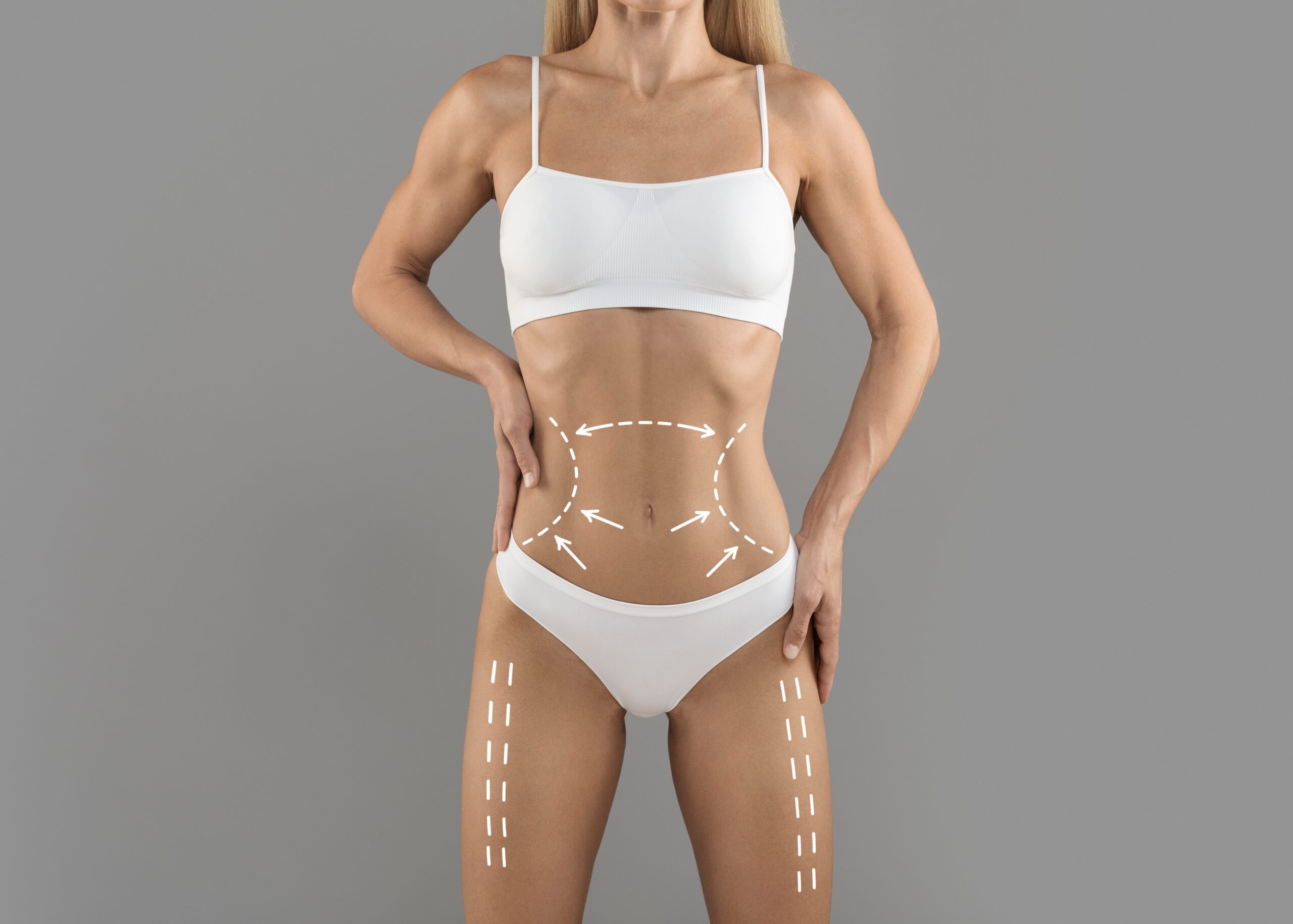 How T Shape 2 Supports Medical Weight Loss